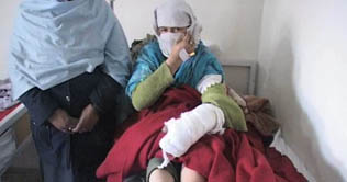 Skardu: man arrested for tying her sister 